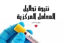 الاستعلام عن نتيجة تحاليل المعامل المركزية برقم الجواز جامكا بعد 24 ساعة من اجراء الكشف
