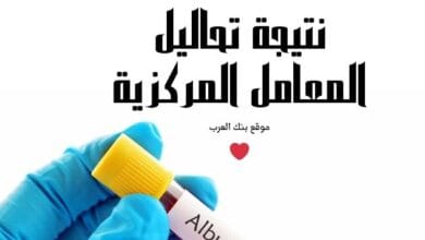 الاستعلام عن نتيجة تحاليل المعامل المركزية برقم الجواز جامكا بعد 24 ساعة من اجراء الكشف